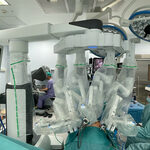Robot da Vinci w BCO. Odwzorowuje ruchy chirurga. Kosztował fortunę